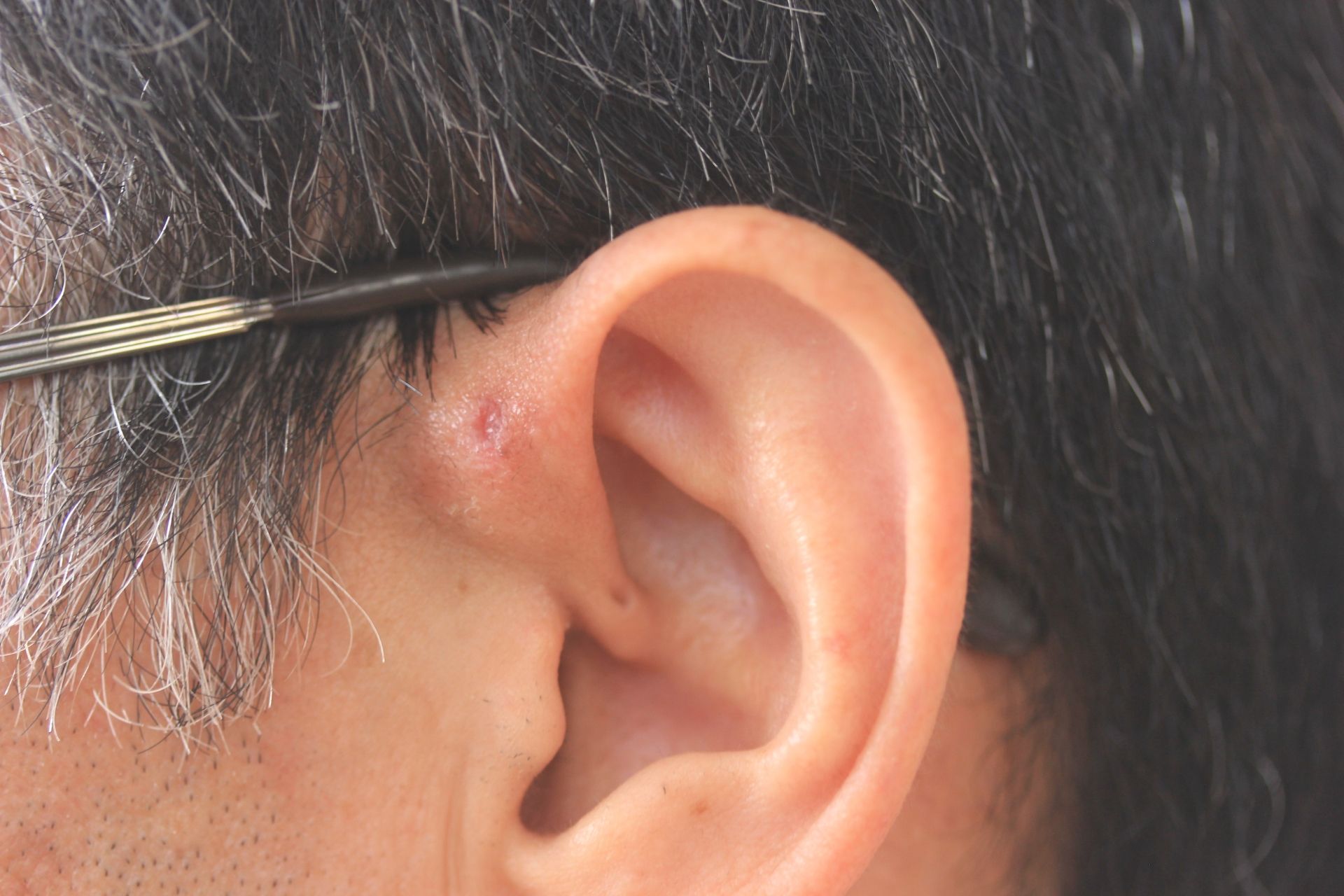 耳鼻科医考案「耳を鍛える」新習慣！「加齢性難聴」に立ち向かう50歳からの「聴力アップ」耳活ガイドの画像