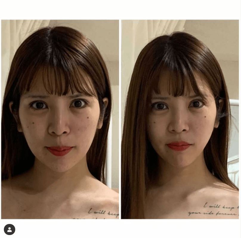 坂口杏里、“整形級”小顔施術のビフォーアフター写真公開もツッコミ相次ぐ「遠近法」「撮り直して」の画像